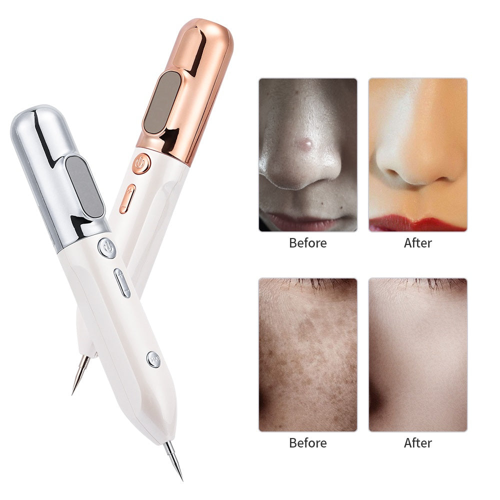 Mole & Skin Tag Removal Plasma Pen