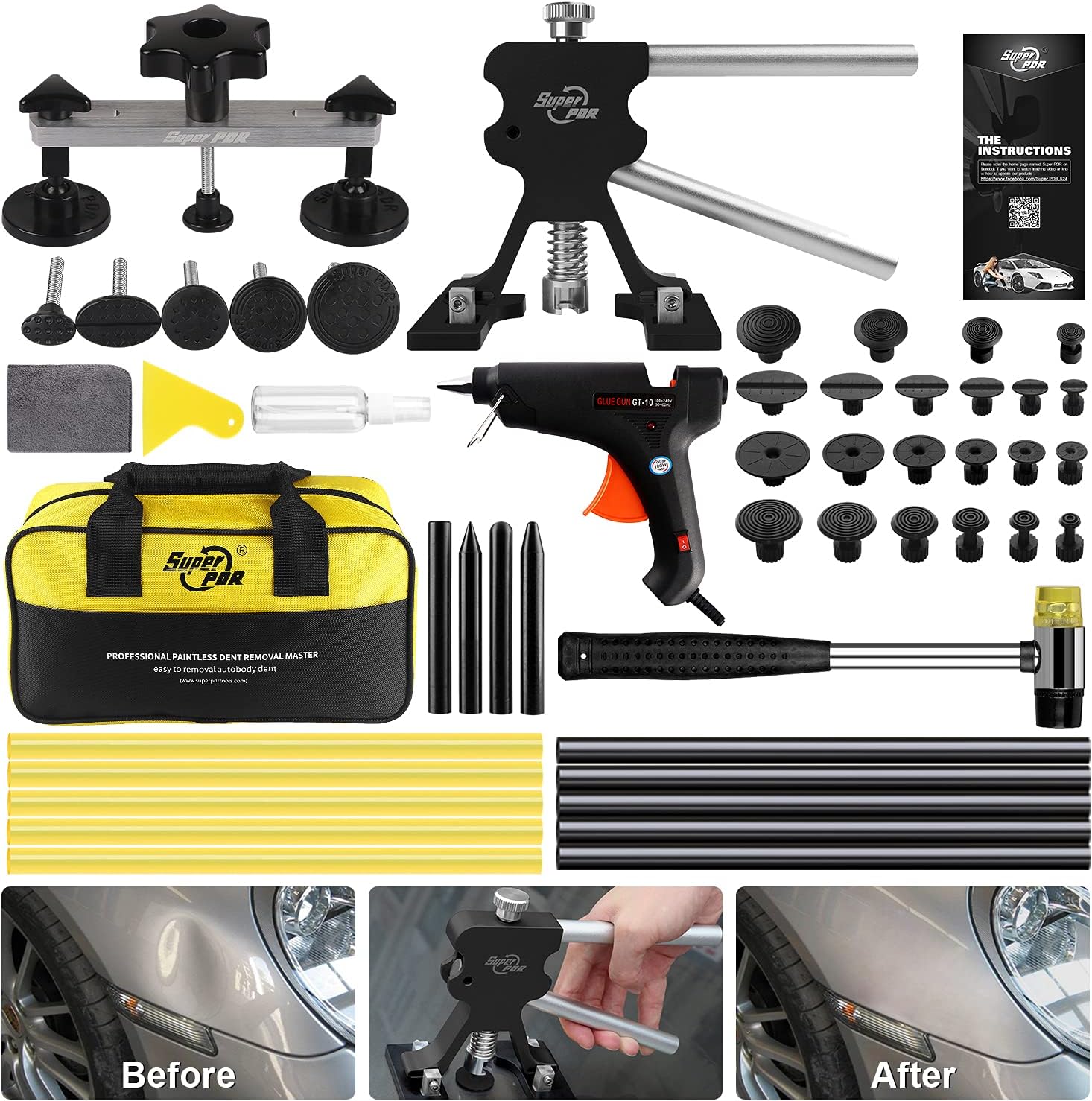 Super PDR Paintless dent Repair kit - Car Dent Repair Kit with Adjustable Black Dent Lifter Puller and Bridge Dent Puller for Car Body Hail Dent Removal Dent Remover Automobile Body Repair