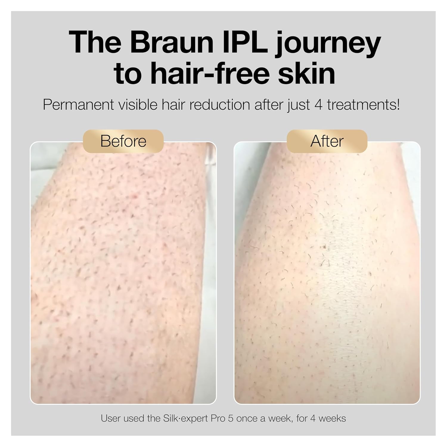 Braun IPL Silk·expert Pro 5 PL5347 Latest Generation IPL for Women and Men, At-Home Hair Removal System, White and Gold, with Wide Head and Two Precision Heads
