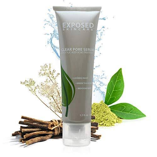 Exposed Skin Care Acne Treatment: Basic Kit for All Skin Types