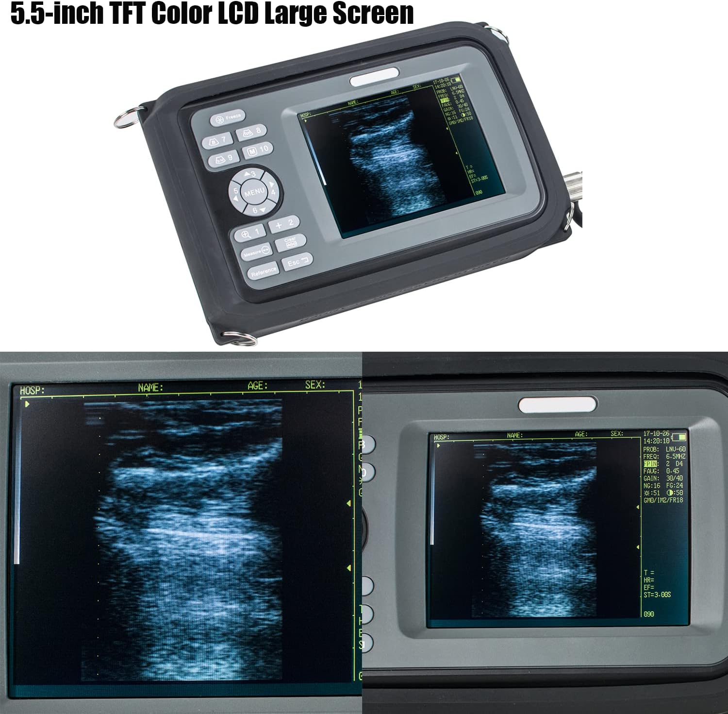 meadowmaze Veterinary Portable Ul-tra-Sound Scanner Pregnancy Digital Handhold Vet Ultra Sound Machine V8 with 4.0MHz Rectal Convex Pro-be for Puppies, Cat and Pig, Goat