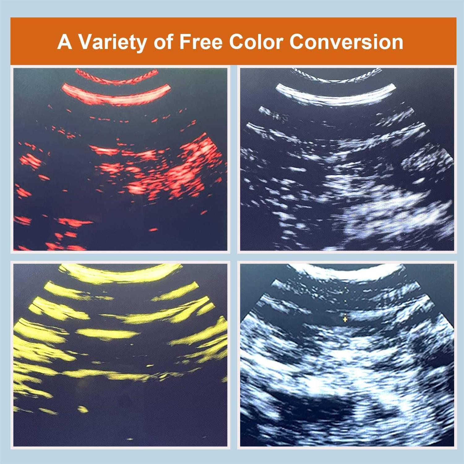 GOYOJO Wireless Veterinary Ultrasound Scanner for Cow Portable Ultrasound Scanner Veterinary Pregnancy - Pet Supplies online store