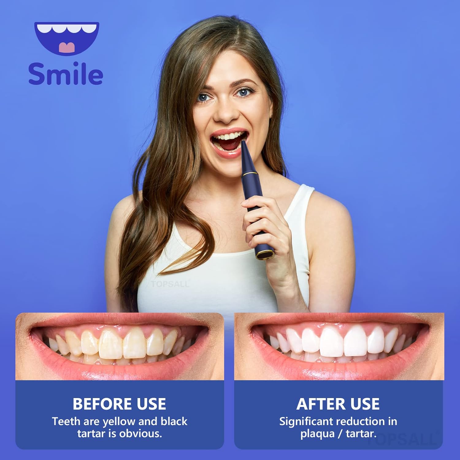 Plaque Remover for Teeth with 1080P HD WiFi Camera | Electric Tooth Cleaner Calculus Remover, Wireless Teeth Cleaning Kit for Adults Pack of 2