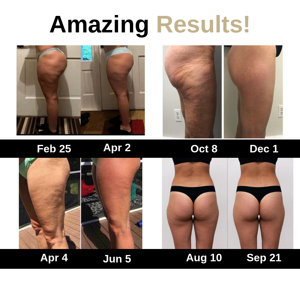 Real customer before and after photos over several months