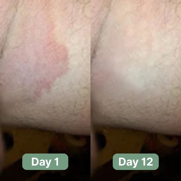 Veloma-Antifungal Soap®