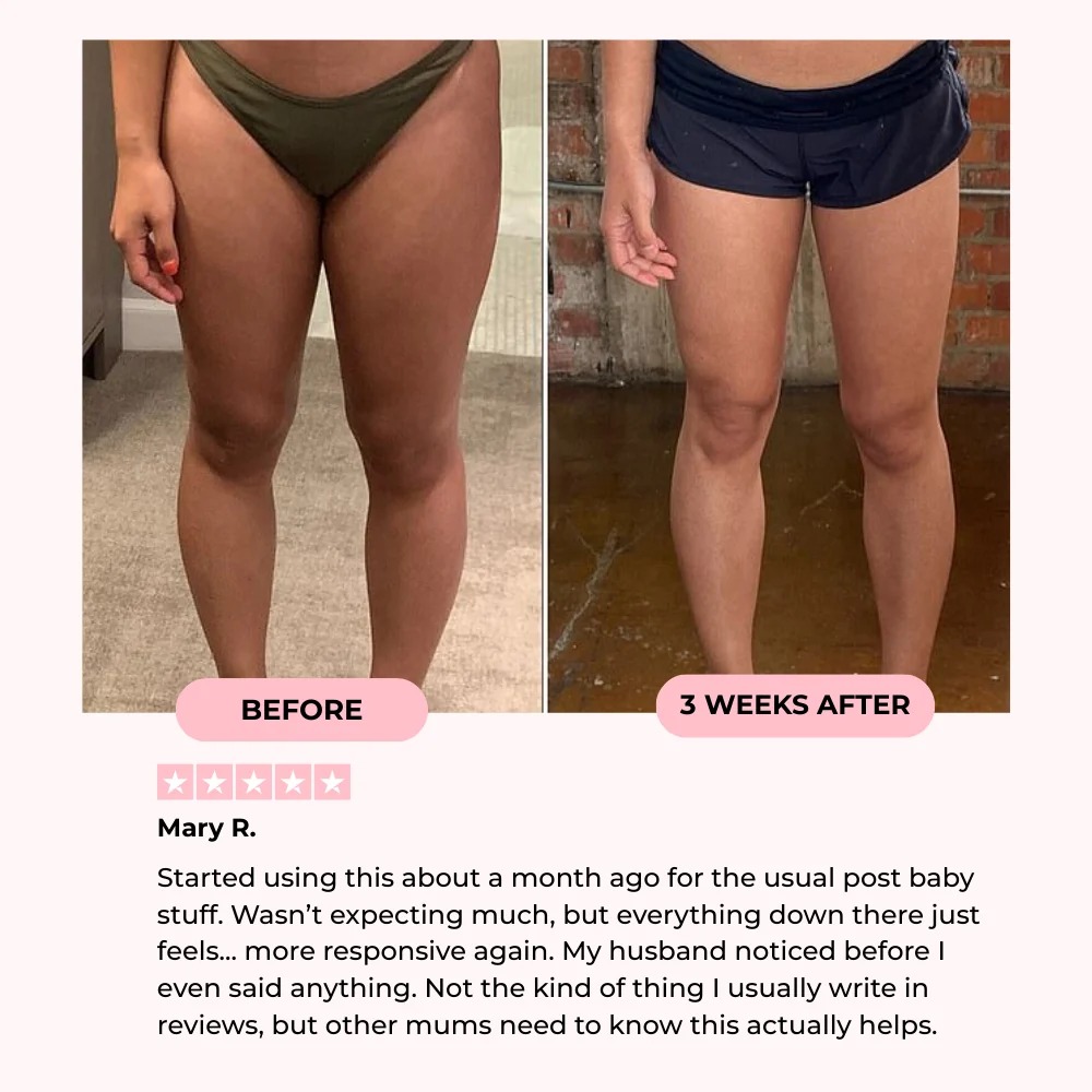 Fit™ Thigh & Pelvic Trainer