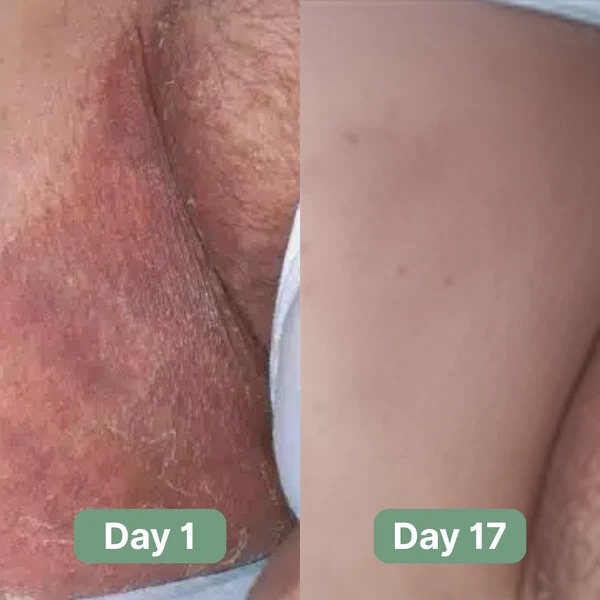 Veloma-Antifungal Soap®