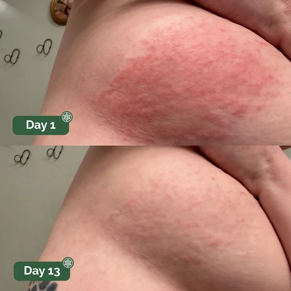 Veloma-Antifungal Soap®