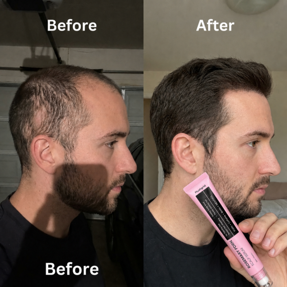 Customer before and after hair result 3