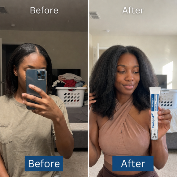 Customer before and after hair result 4