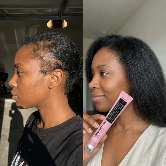 Customer before and after hair result 1