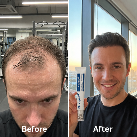 Customer before and after hair result 6