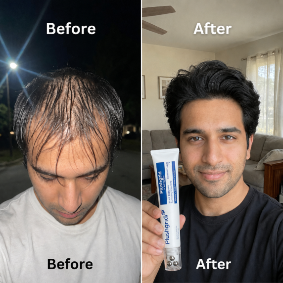 Customer before and after hair result 2