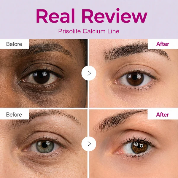 LAST DAY 50% OFF!! Prisolite Korean Calcium Dark Spot Eye Cream