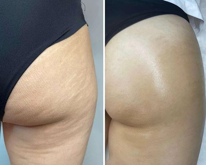 Ceoerty® NAD+ Peptide Firming & Lifting Cream