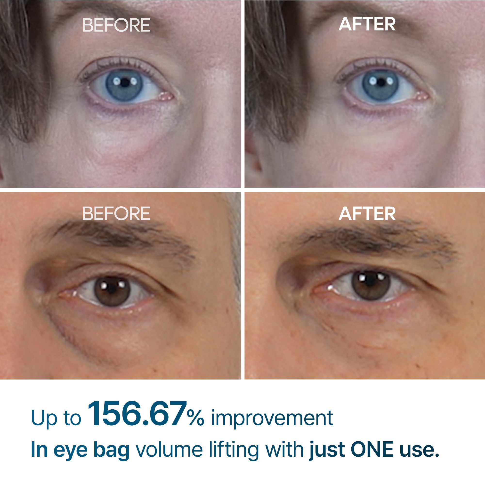 Seurico™ Advanced Firming Under-Eye Cream