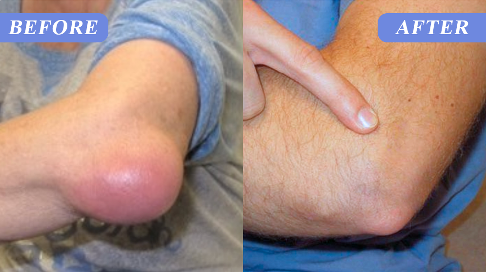 Seurico™ Premium Curcumin Pain Relief Gel