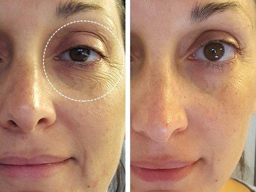 Why You Need Both Vitamin C and Retinol
 – EVER Skincare