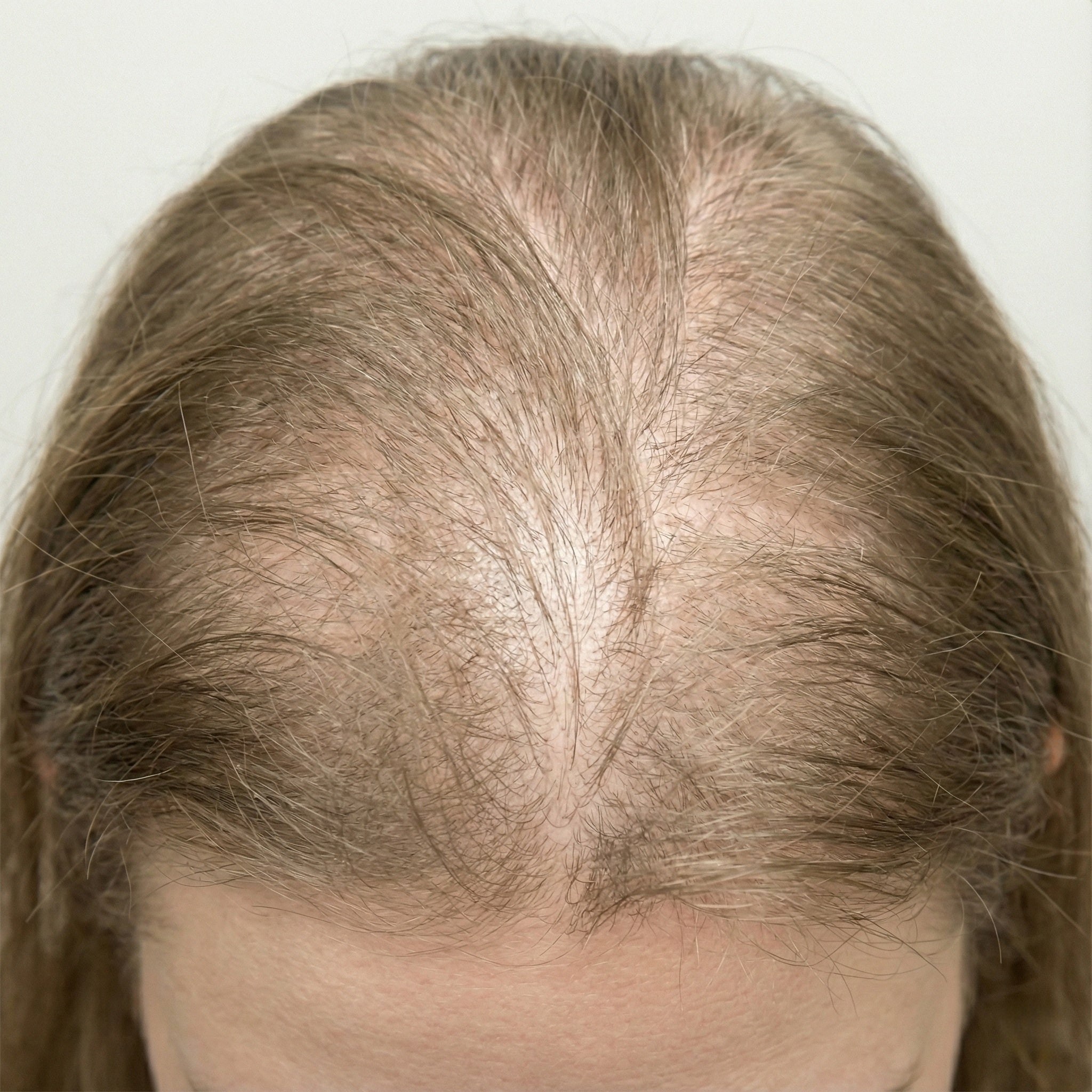Before using Seurico shampoo
