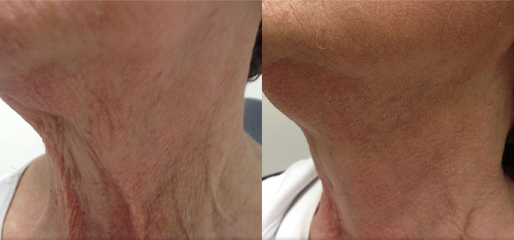 Ceoerty® NAD+ Peptide Firming & Lifting Cream