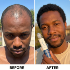 Before and After 4