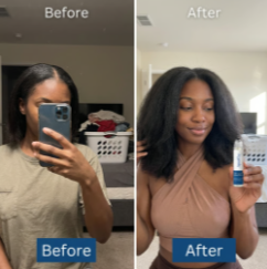 Before and After 5