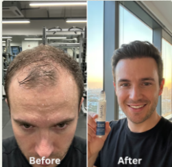 Before and After 2