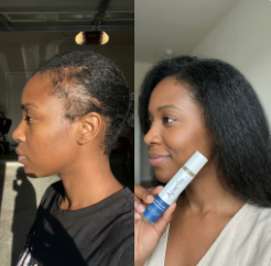 Before and After 3