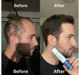 Before and After 1