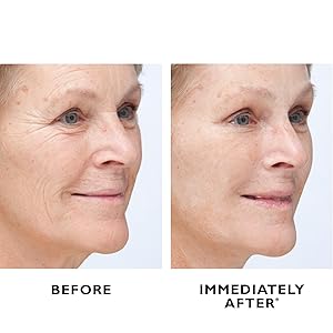 Peter Thomas Roth, Instant FIRMx Temporary Face Tightener, before and after B&amp;A