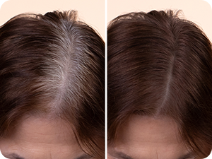 Hairline Powder