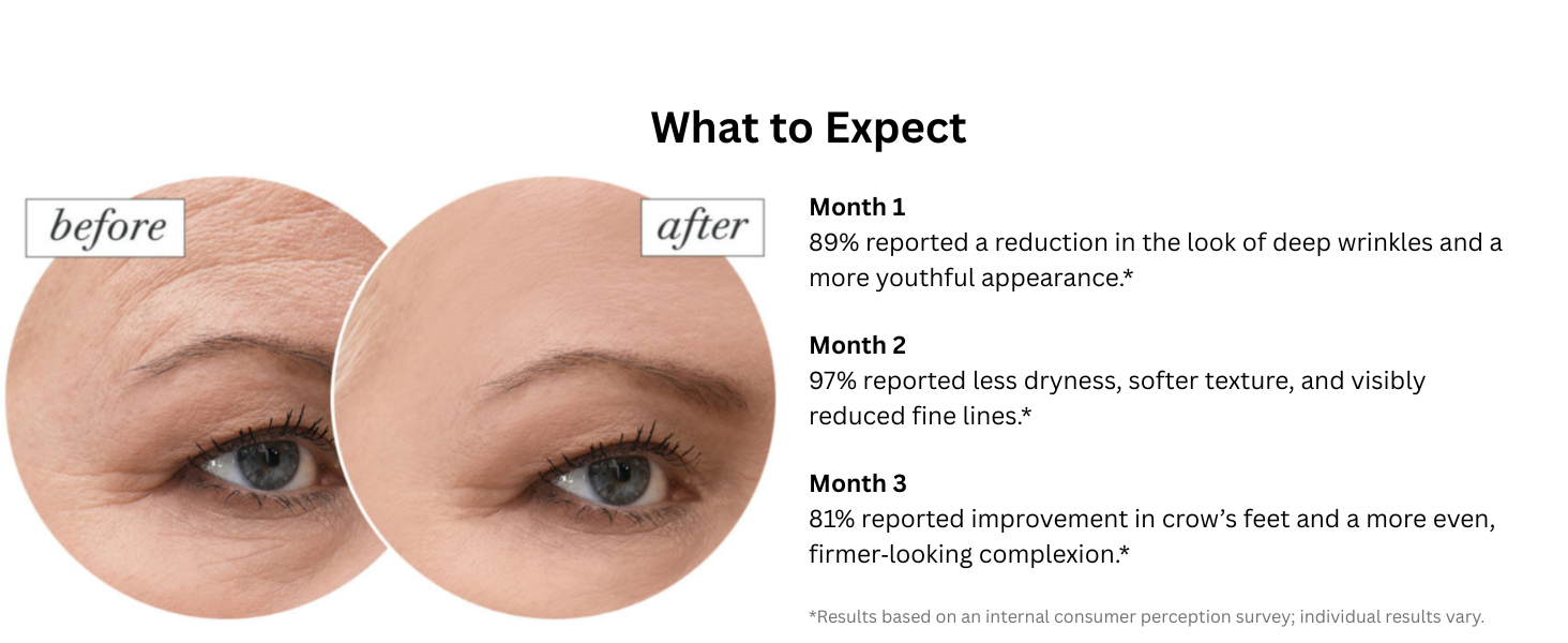 Stemuderm helps improve appearance of skin