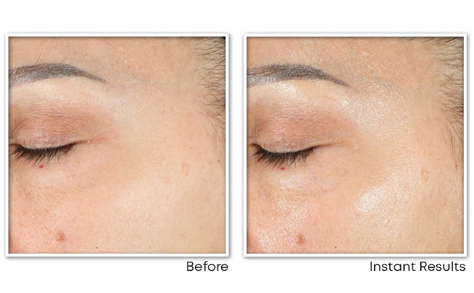 Visible Results: Before Vitamin C Serum and After 4 Weeks