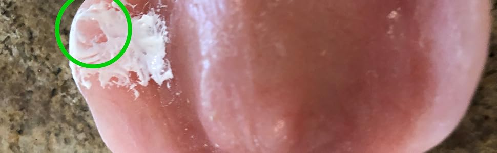 denture sore spot located