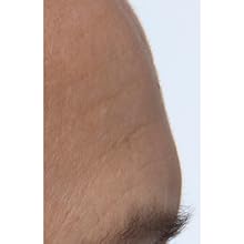 Peter Thomas Roth, Potent-C Power Serum, forehead, after
