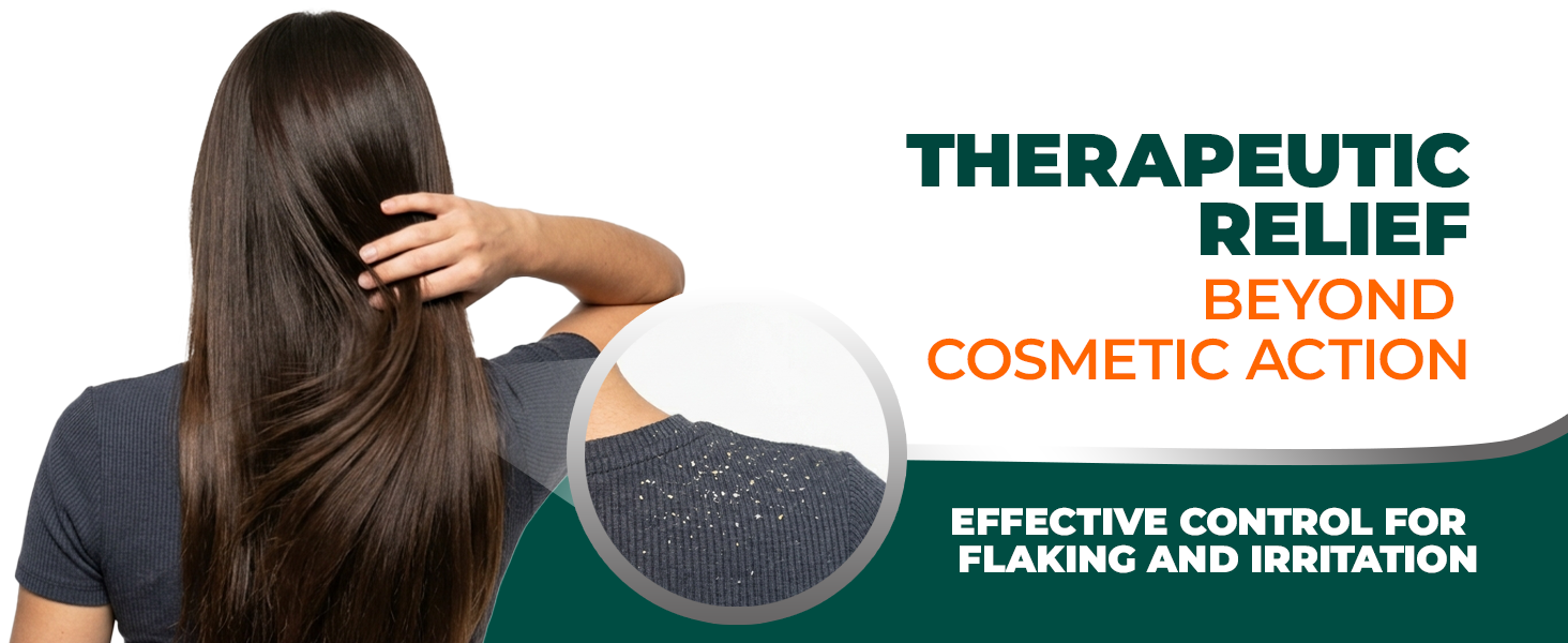 Medicasp Anti-Dandruff Shampoo for flaking and scalp irritation, woman with long hair and zoom view