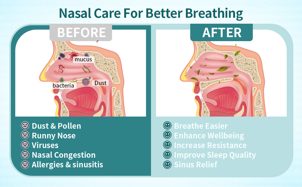 Nasal Irrigation System