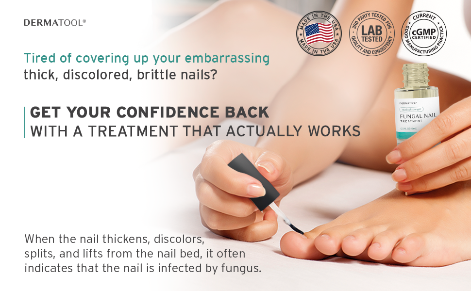 toenail fungus treatment