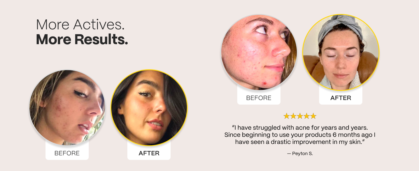 more active ingredients more results