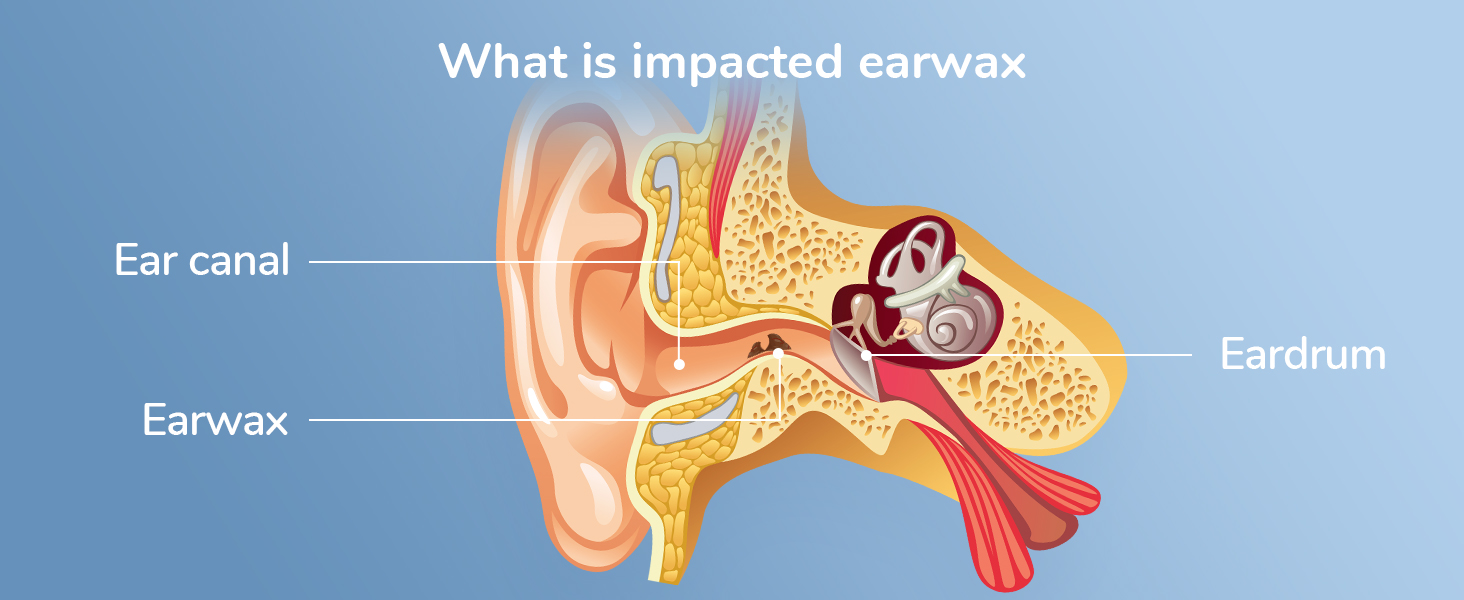 ear scope