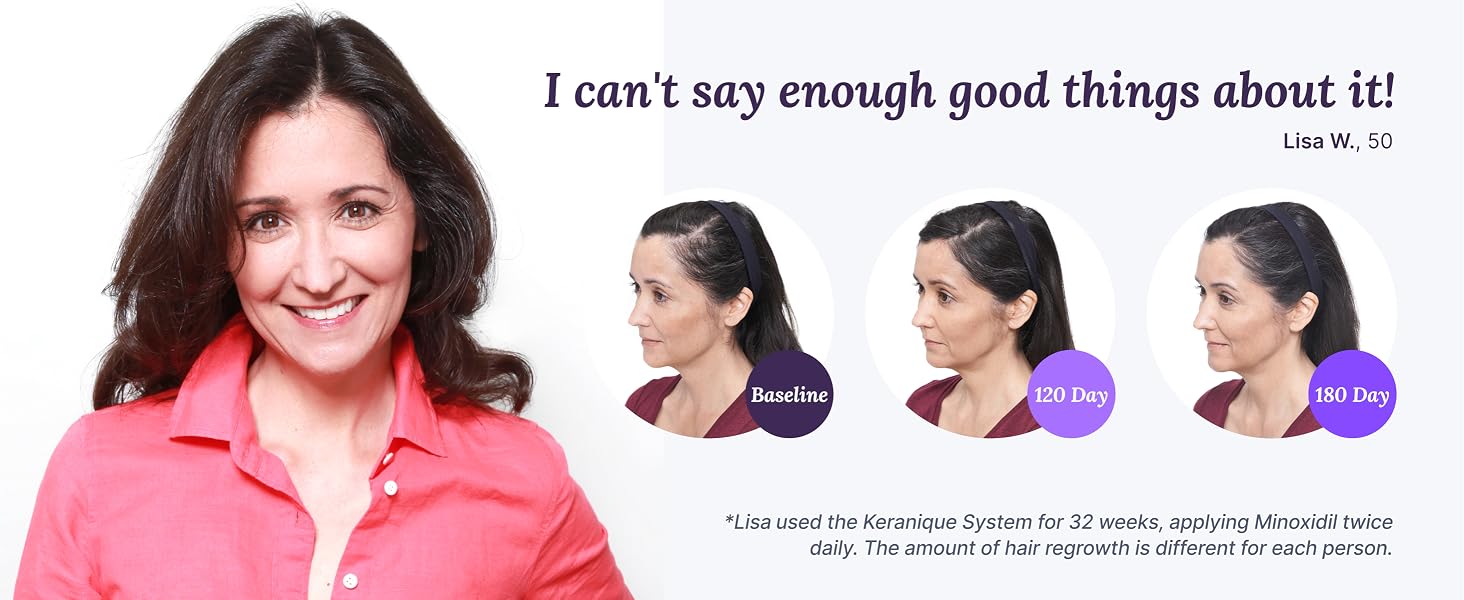 Keranique Hair Regrowth Treatment Minoxidil Women 2 Percent Dropper Growth Loss Thickening Thinning.