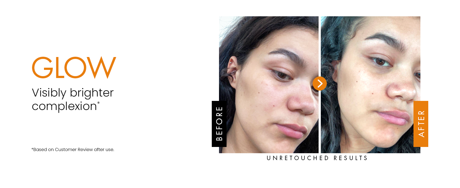 vitamin c and hyaluronic acid serum l-ascorbic acid vitamin c serum day glow serum - vitamin c serum