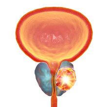 prostate palmetto urinary health better sleep