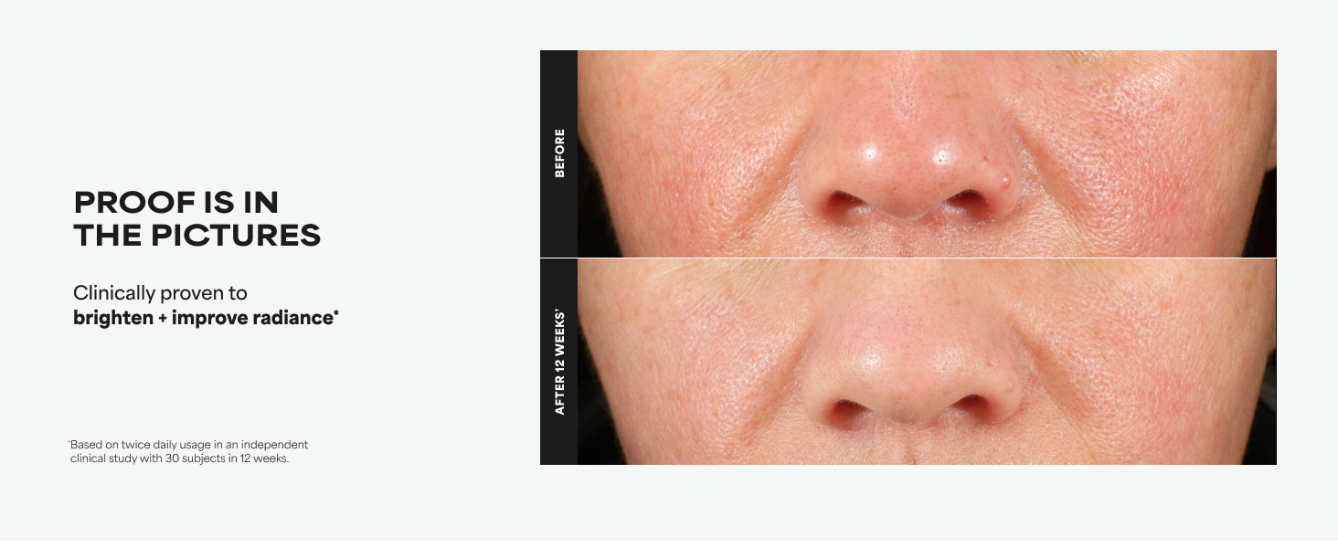 C15 Super Booster dullness uneven tone vitamin c brightening glow serum skin care paulas choice