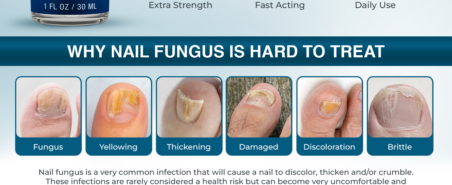 Funginix