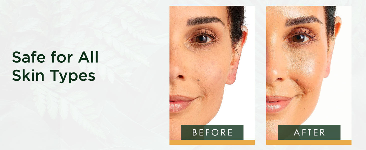 Before and after comparison showing the visible results of Tree of Life Vitamin C Serum