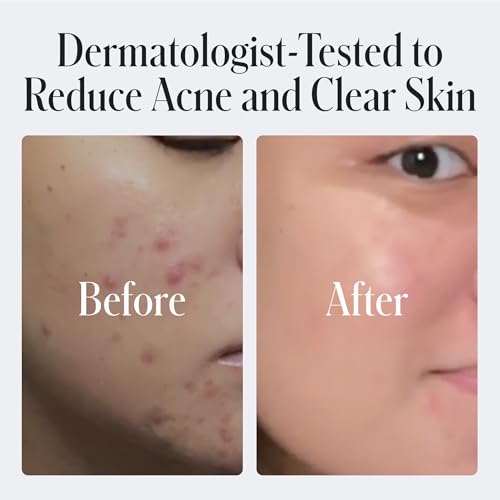 Geologie Daily Face Wash for Sensitive Skin | Fragrance-Free Facial Cleanser for Men & Women | Acne & Oil Control | Non-irritating