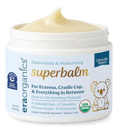 Superbalm USDA Organic Healing Ointment for Baby Eczema & Cradle Cap - 2oz | 100% Natural Soothing Superfood Cream for Toddler & Kids - Eczema, Cradle Cap, Baby Acne & Rashes - Non-Toxic, Fragrance-Free