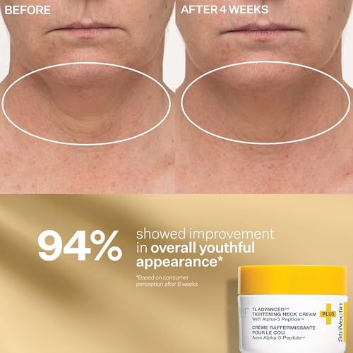 StriVectin Tighten & Lift Peptight Face Lift Serum with Tightening & Brightening Peptides for Wrinkles