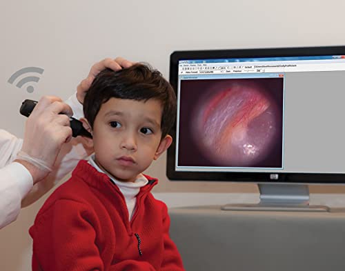 Firefly DE550 Wireless Digital Video Otoscope/Earscope for Audiology, Pediatrics, and Primary Care. F.D.A. and C.E. Certified.